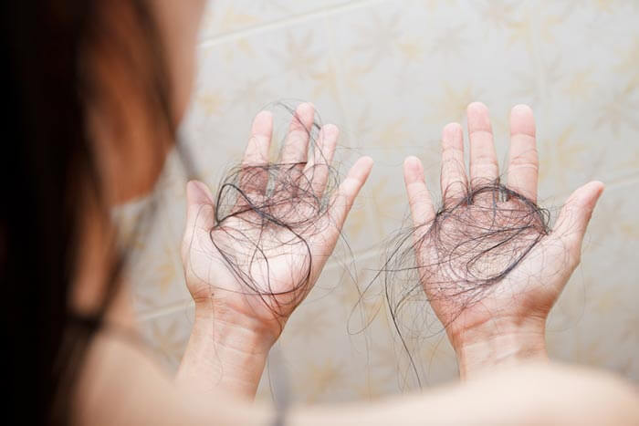 ผมร่วงเต็มมือ